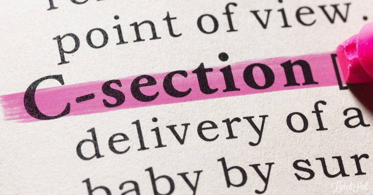 What to expect with a c section